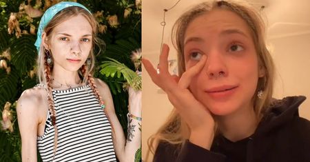 18-letnia tiktokerka otwiera się na temat ANOREKSJI: "Straciłam chęć do życia, doszły MYŚLI SAMOBÓJCZE..."