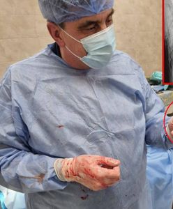 Niezwykła operacja w Ukrainie. To wyjęli z ciała rannego żołnierza