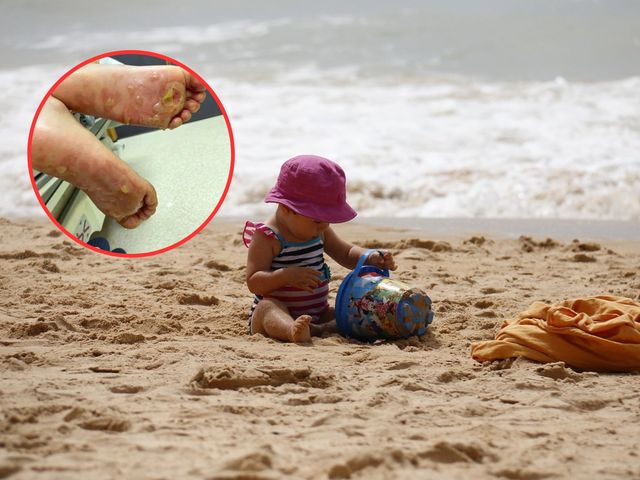 2-latka biegła po plaży. "Zaczęła przeraźliwie krzyczeć"