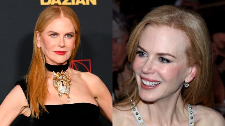 Te gwiazdy pożałowały operacji plastycznych