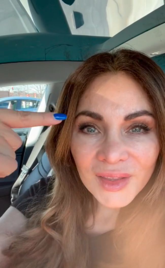 Wstrzykiwała sobie botoks przez 20 lat i przestała. Efekt podzielił internautów