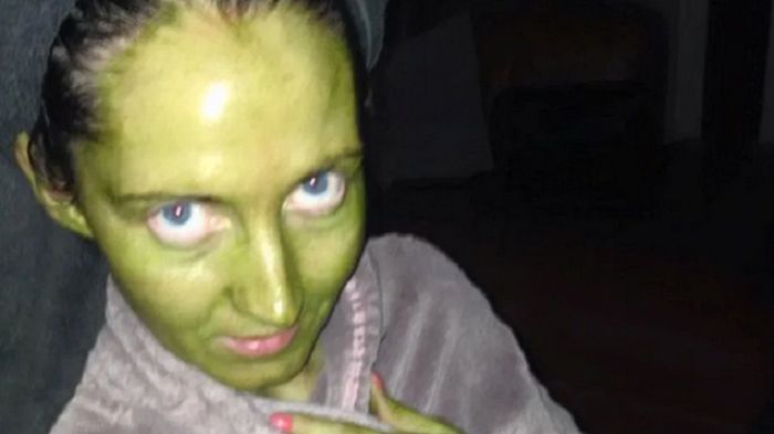 Kobieta ma zielony kolor skóry – wszystko przez przeterminowany samoopalacz