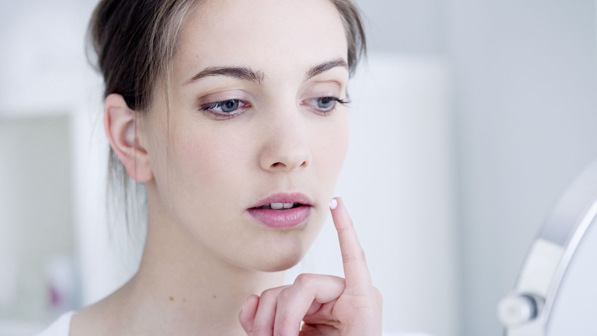 Zimno to popularna nazwa opryszczki wargowej