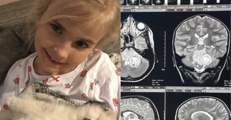 Liliankę po powrocie z ferii bolała głowa. Prześwietlenie pokazało przerażająca prawdę