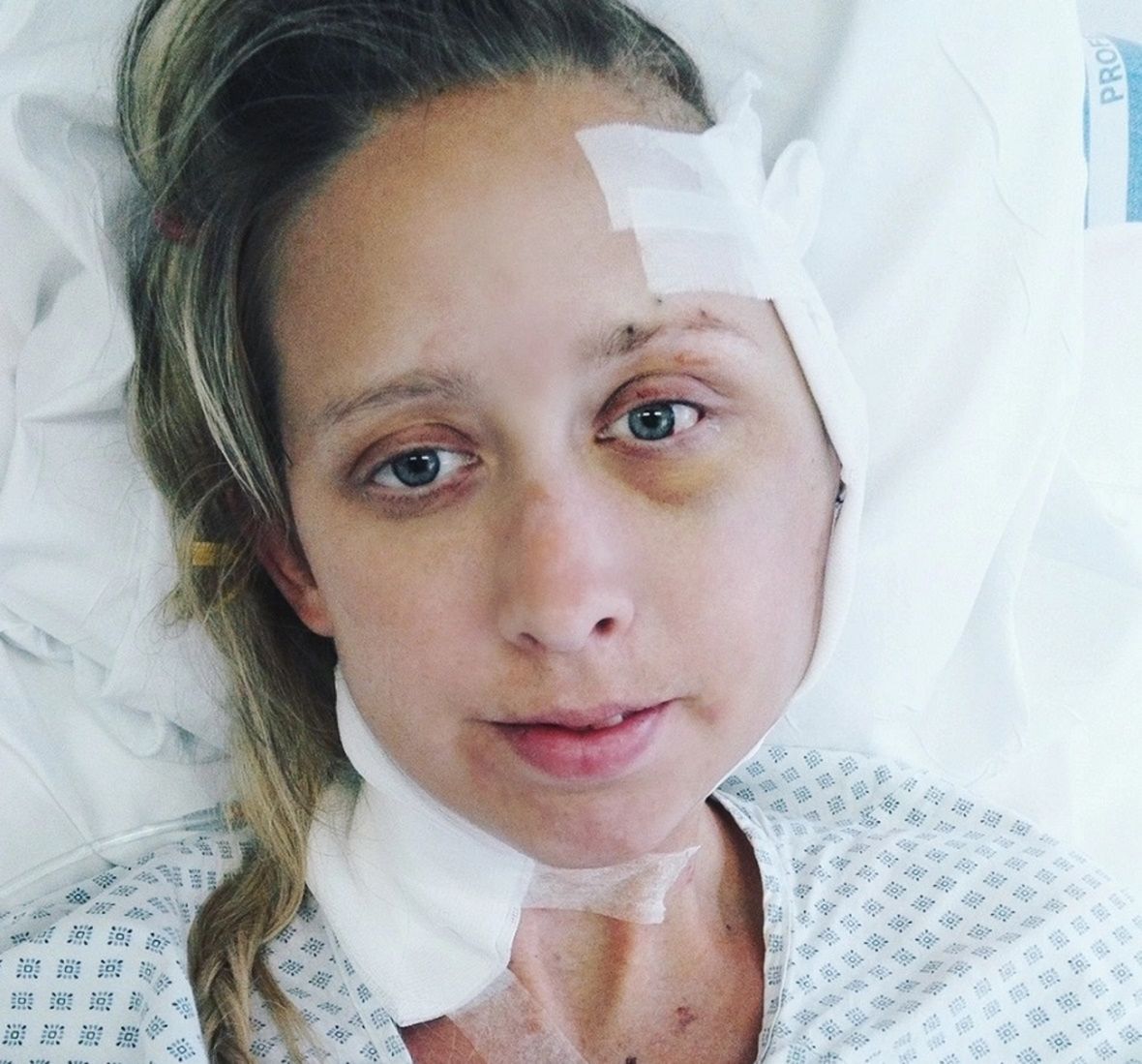 U mamy dwójki dzieci zdiagnozowano rzadki nowotwór skóry