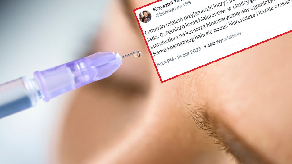 Wstrzyknęła kwas w czoło. Doszło do martwicy