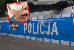 Pies pogryzł 4-latka. Właściciel uciekł, ale został złapany