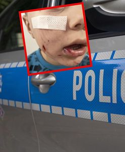 Pies pogryzł 4-latka. Właściciel uciekł, ale został złapany