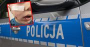 Pies pogryzł 4-latka. Właściciel uciekł, ale został złapany