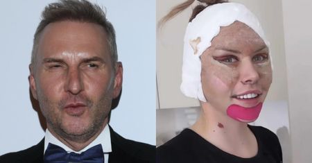 29-letnia Julia von Stein prezentuje efekty liftingu CAŁEJ TWARZY, a Krzysztof Gojdź grzmi: "TO NIEPOROZUMIENIE"