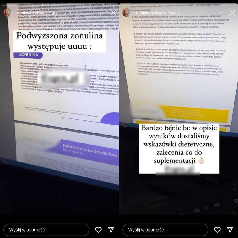 Małgorzata Borysewicz z "Rolnik szuka żony" prezentuje wyniki badania jelit