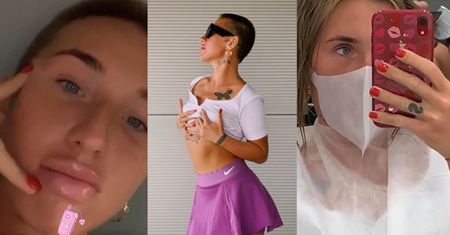 Marta Linkiewicz OGOLIŁA SIĘ na jeża! Udana metamorfoza?
