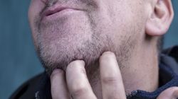 Charakterystyczny znak uszkodzonej trzustki. Widać go gołym okiem