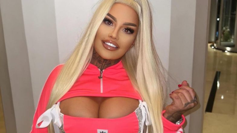 Tak wyglądała Laluna PRZED OPRACJAMI PLASTYCZNYMI