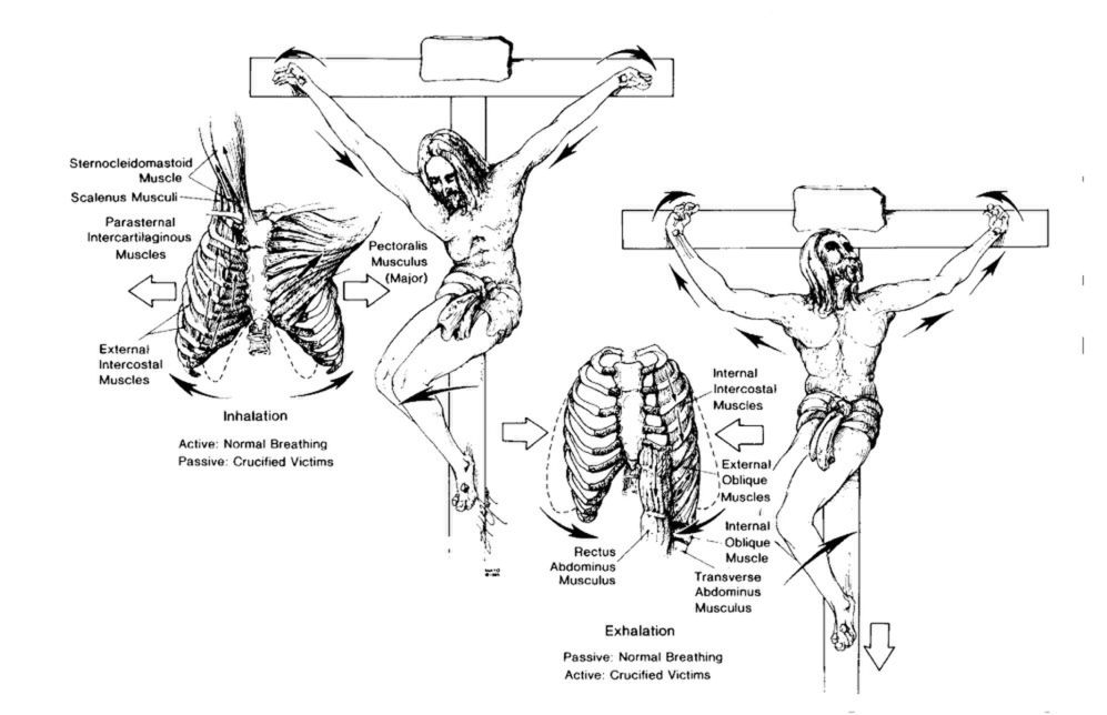Ukrzyżowanie - schemat obciążeń, odziałujących na ciało