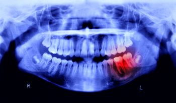 Robot zastąpi dentystę? Chińczycy opracowali niezwykłą technologię