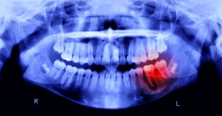 Robot zastąpi dentystę? Chińczycy opracowali niezwykłą technologię