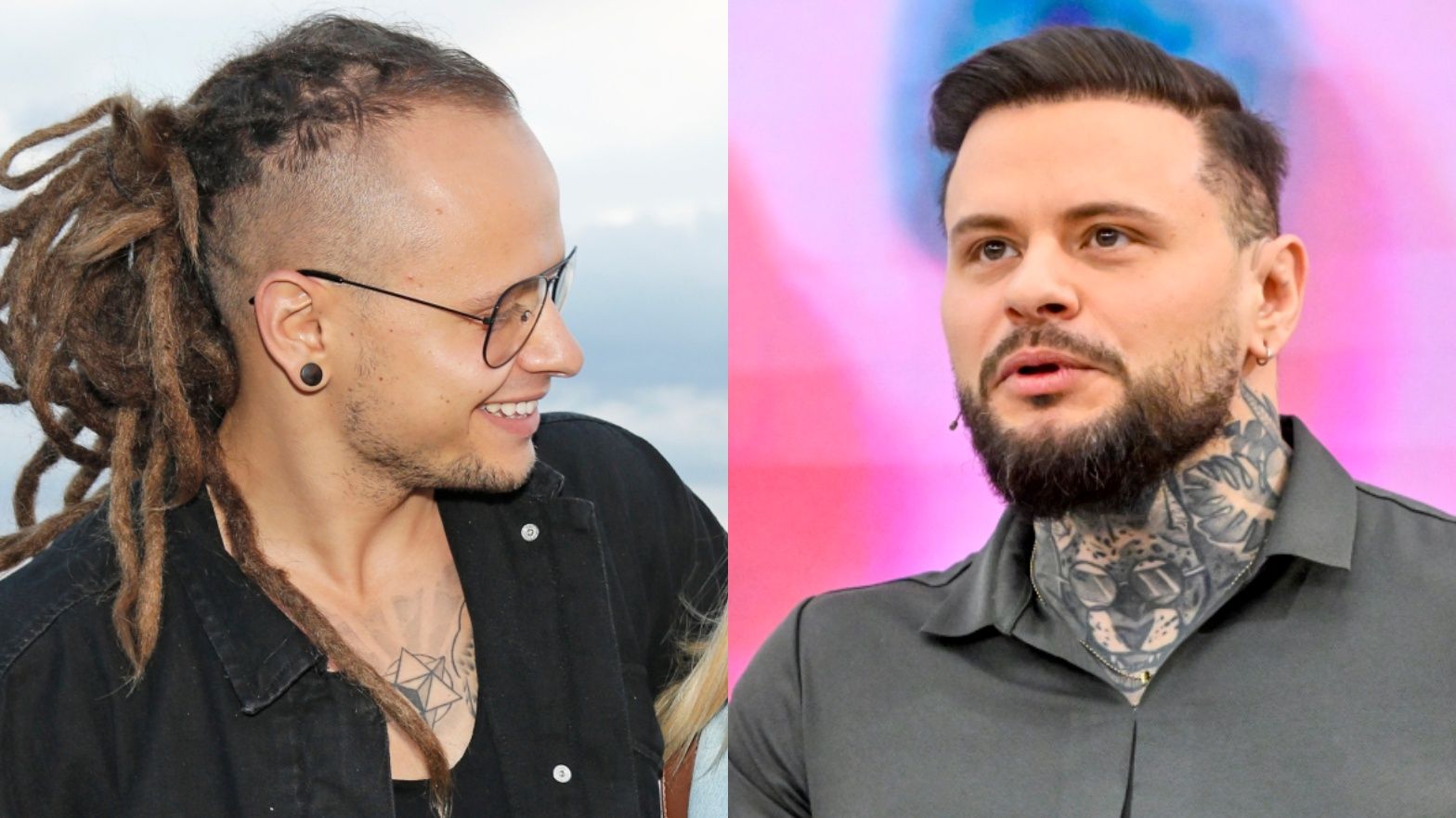 Mateusz Janusz przed i po przeszczepie włosów