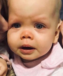 Wrocław. Apel prezydenta. Mia czeka na pomoc