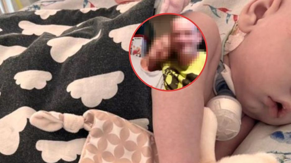 Ruszyła zbiórka na rzecz maltretowanego Marcinka. "Żałuję, że nie posiadam mocy, by cofnąć czas"