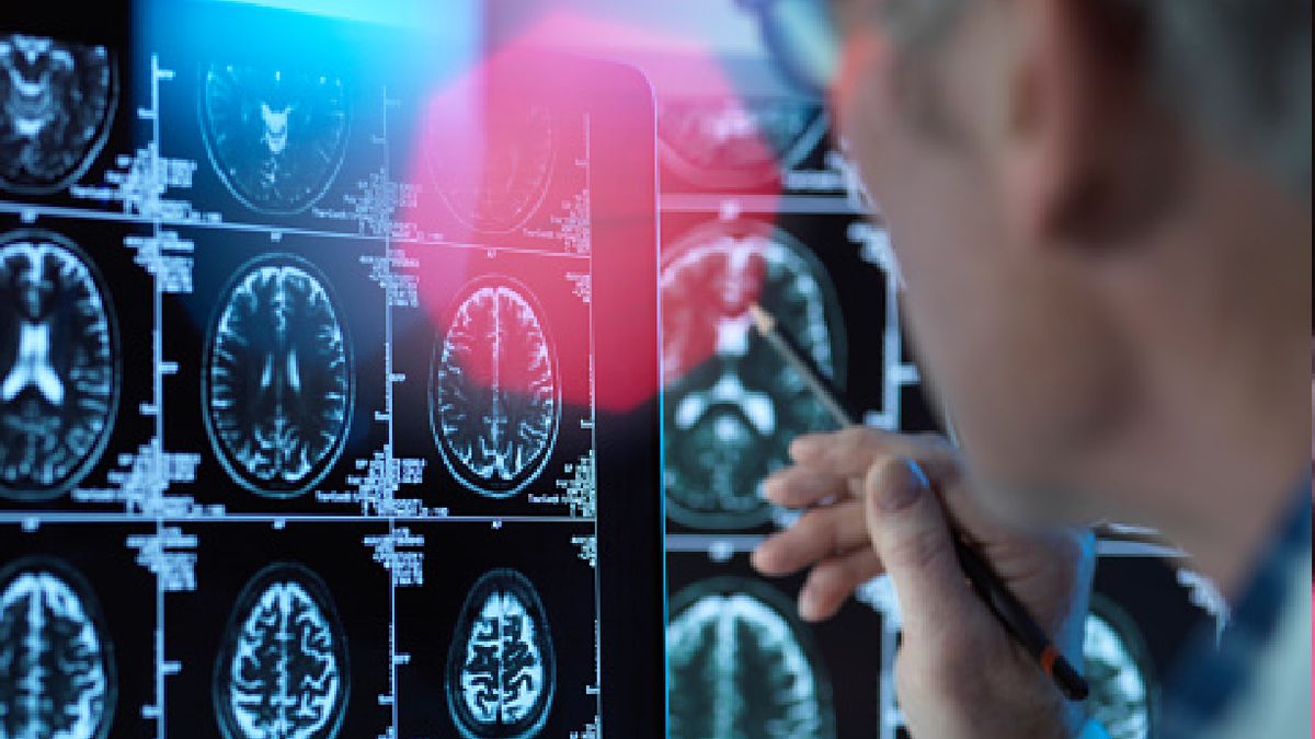 Naukowcy zbadali mózg umierającego.