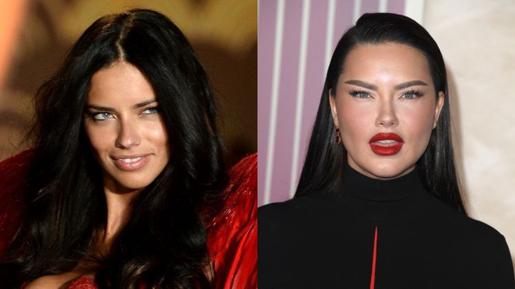 Adriana Lima zabrała głos w sprawie wyglądu jej twarzy