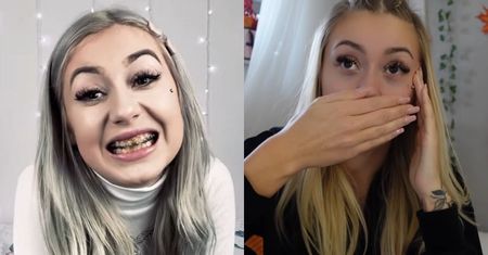 Tiktokerka Kinia Wiczyńska prezentuje NOWE ZĘBY! Pokazała też, jak wyglądały "stare" po SPIŁOWANIU: "Okropny widok" (FOTO)