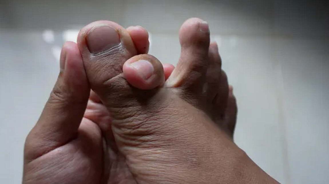 Twoje stopy mogą zdradzić stan zdrowia. Tak rozpoznasz problemy z krążeniem i cukrzycą