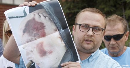Lubin. Rodzina zmarłego 34-latka pokazała zdjęcia. "Ciało jest poturbowane i zasinione"