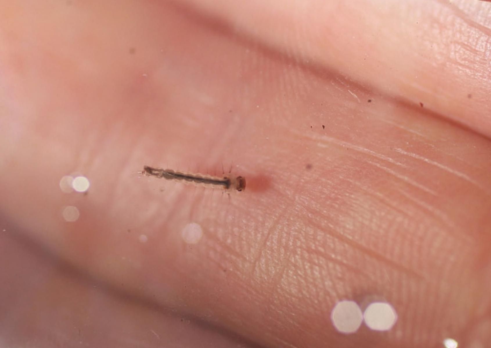 Jak skutecznie pozbyć się owadów?