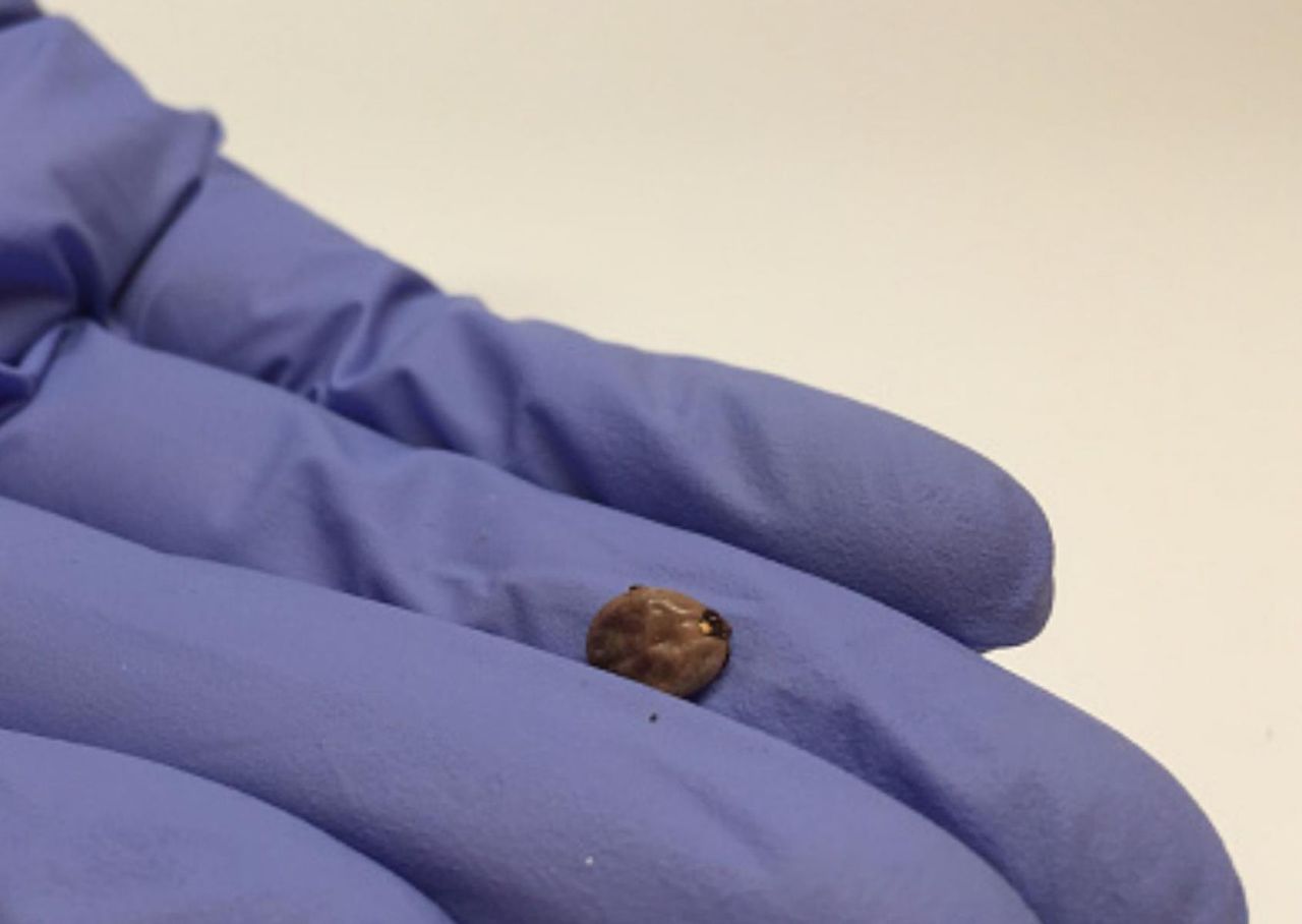 Uważaj na groźne nimfy kleszcza. Można je łatwo pomylić z pieprzykiem