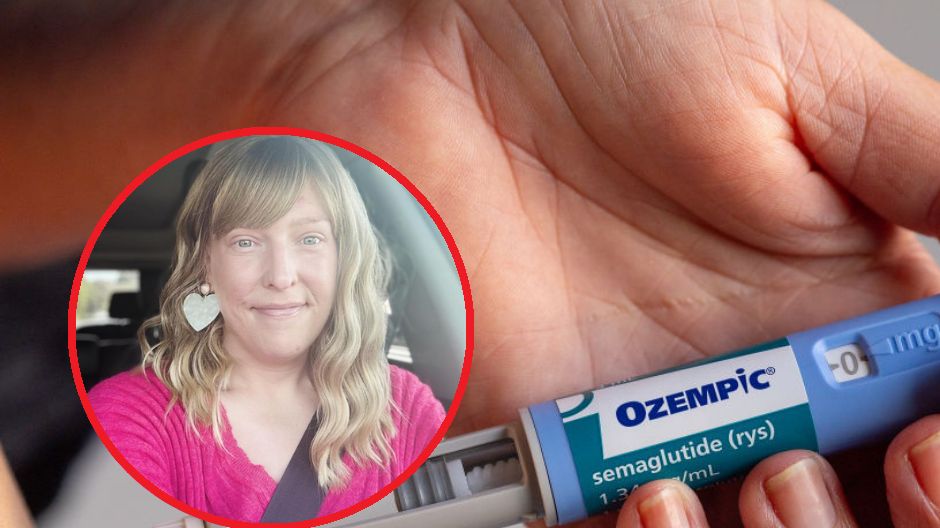 Opowiedziała o skutkach ubocznych Ozempiku