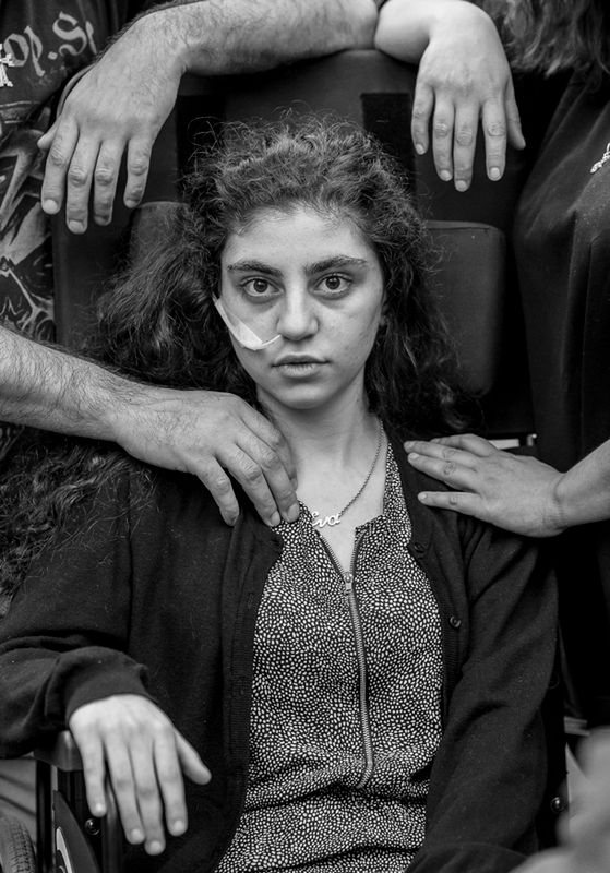 Ewa, 15-letnia Ormianka obudziła się po 8 miesiącach katatonii wywołanej przez syndrom rezygnacji. Siedzi na wózku inwalidzkim otoczona ramionami rodziców. Wciąż grozi im deportacja do Armenii, 1 czerwca 2019Zdjęcie dominowane do World Press Photo 2020