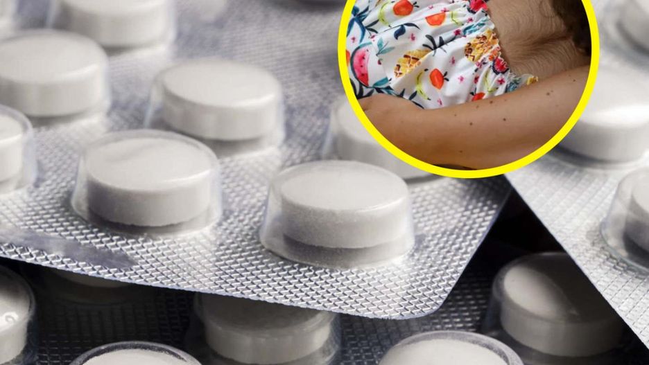 Ojciec stosował ten lek. U dziecka rozwinął się "syndrom wilkołaka"