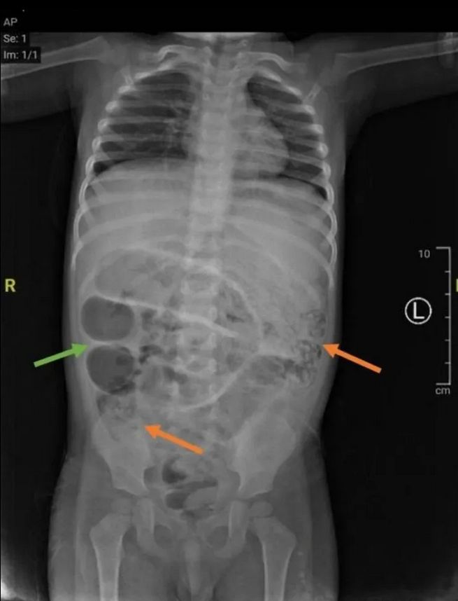 Badania ujawniły przyczynę dolegliwości