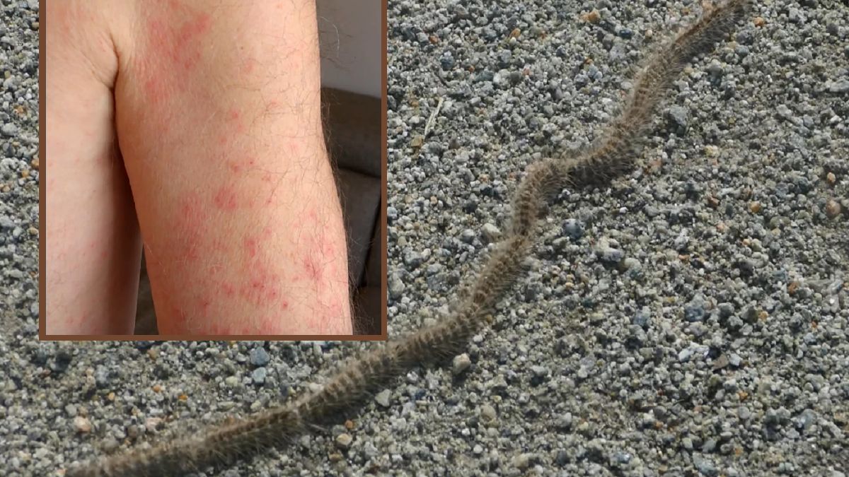 Trujące gąsienice na placu zabaw. Powodują poważne reakcje alergiczne