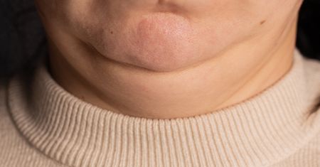Rób codziennie. Podwójny podbródek powoli zacznie znikać