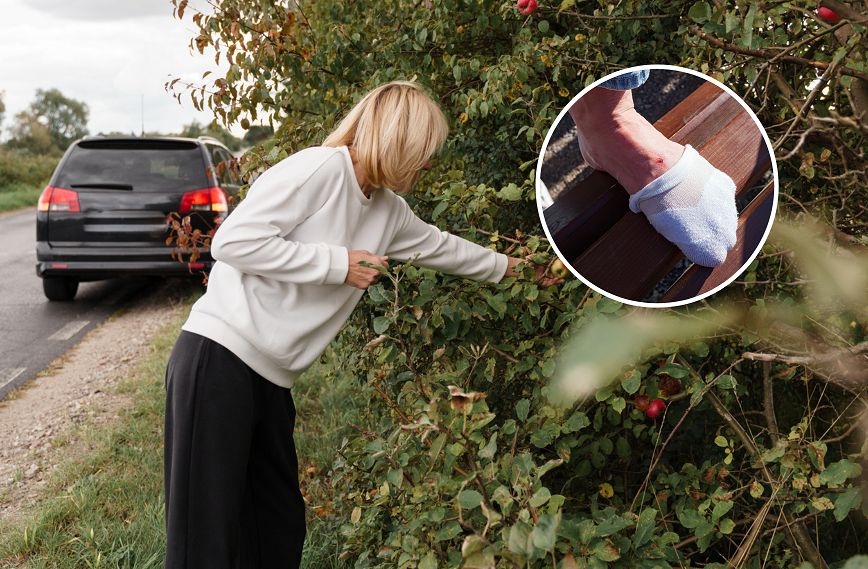 Niszczą serce, śledzionę. Objawy chorób odkleszczowych mogą pojawić się na skórze