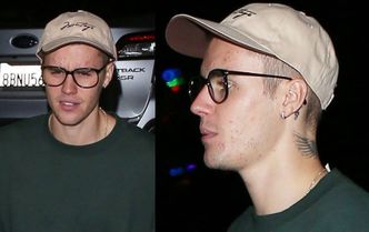 Bieber ma poważne problemy z cerą. Trądzik czy niezdrowy tryb życia? (FOTO)