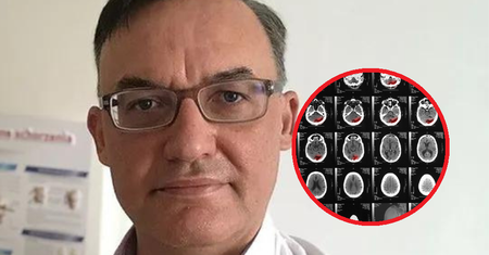 Niepokojące zjawisko. Oto co neurolog zauważa teraz u zakażonych