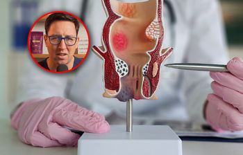 Gastroenterolog ostrzega. "Mogą być wczesnym sygnałem raka jelita grubego"