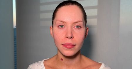 Tak wyglądała Julia von Stein, zanim zdecydowała się na operacje plastyczne (STARE ZDJĘCIA)