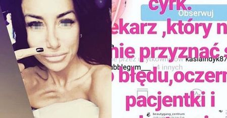 Kobieta oskarżyła chirurga o deformację nosa. Internauci sugerują, że to PRZEZ ZAŻYWANIE KOKAINY!