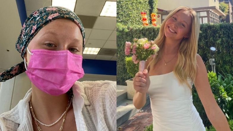 19-letnia Miranda McKeon walczy z rakiem piersi