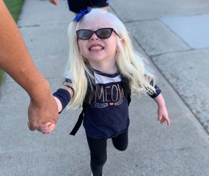 Albinizm nie ogranicza dziewczynki