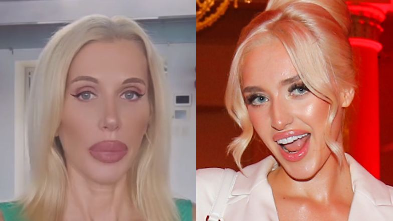 Caroline Derpienski komentuje rozstanie Anety Glam