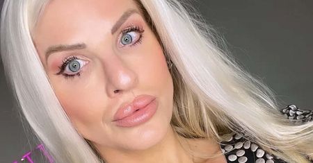 37-latkę nazywano "Spaczoną Barbie". Wszystko przez pewien defekt