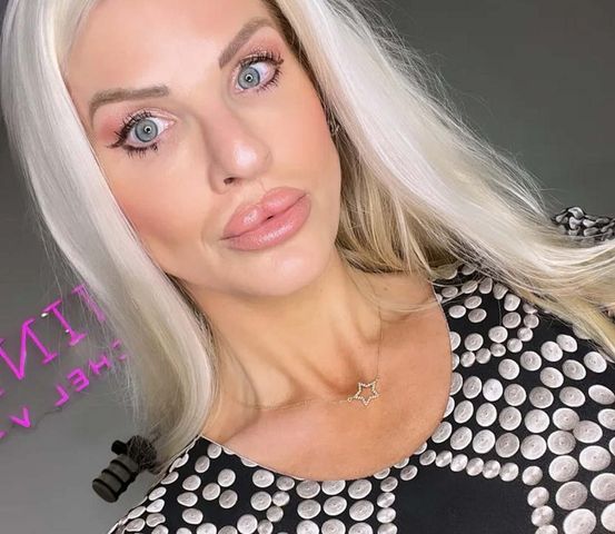 "Spaczona Barbie" urodziła się z wadą rozwojową twarzoczaszki