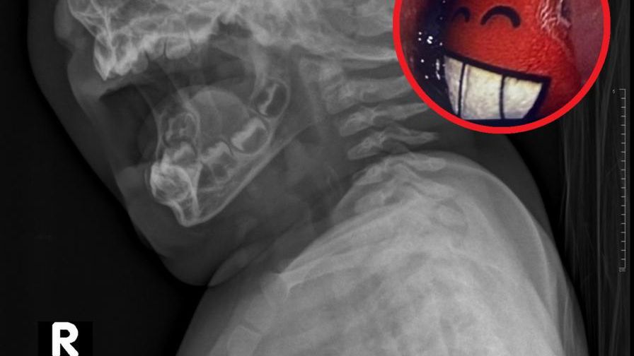 9-miesięczne dziecko trafiło na SOR. Pod koniec badania lekarze nie mogli powstrzymać śmiechu