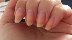 Znak, że serce szwankuje. Objaw zauważysz na dłoniach